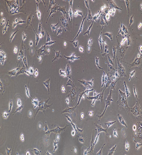 Annexin V流式檢測細胞凋亡的數(shù)據(jù)分析方法