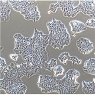 NMC-G1人腦膠質(zhì)細胞瘤