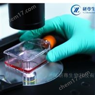 NIH:OVCAR-3人卵巢癌腺癌細胞