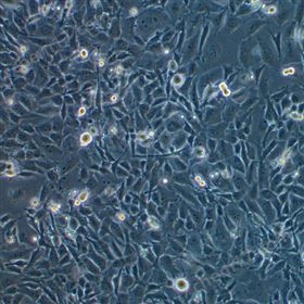 人小細胞肺癌細胞SW1271(STR鑒定正確)