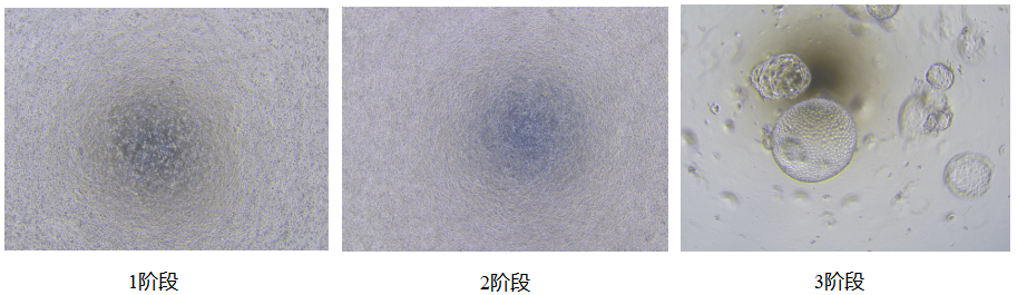 IPS誘導(dǎo)肝類器官培養(yǎng)攻略