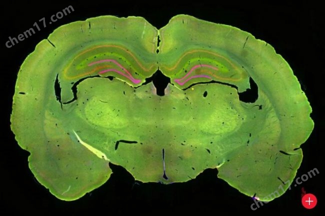 MICA寬焦活細胞 全場景顯微成像分析平臺