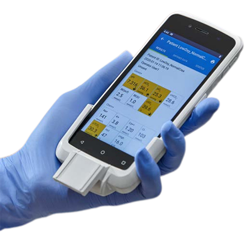 epoc Blood Analysis System 血气分析仪(3).jpg