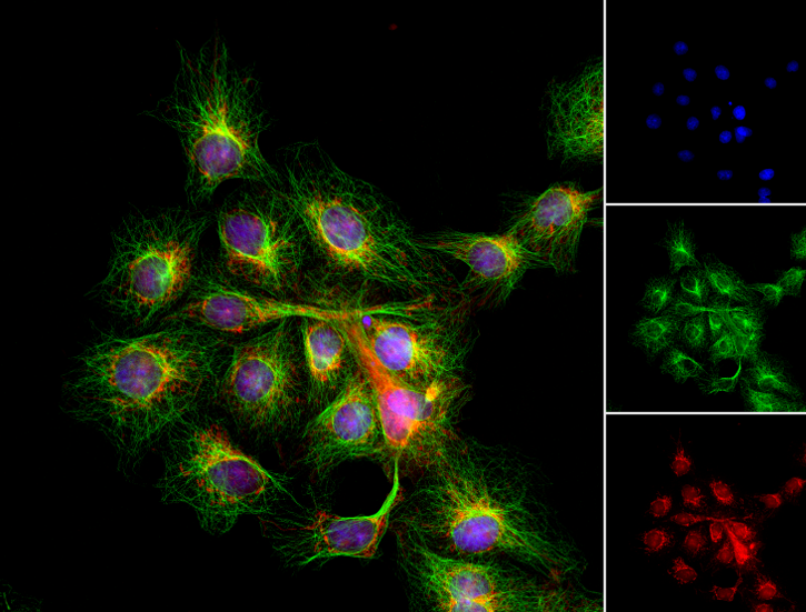 新品發(fā)布︱蔡司Axiovert 7，兼顧常規(guī)細胞培養(yǎng)和復雜研究的倒置顯微系統(tǒng)