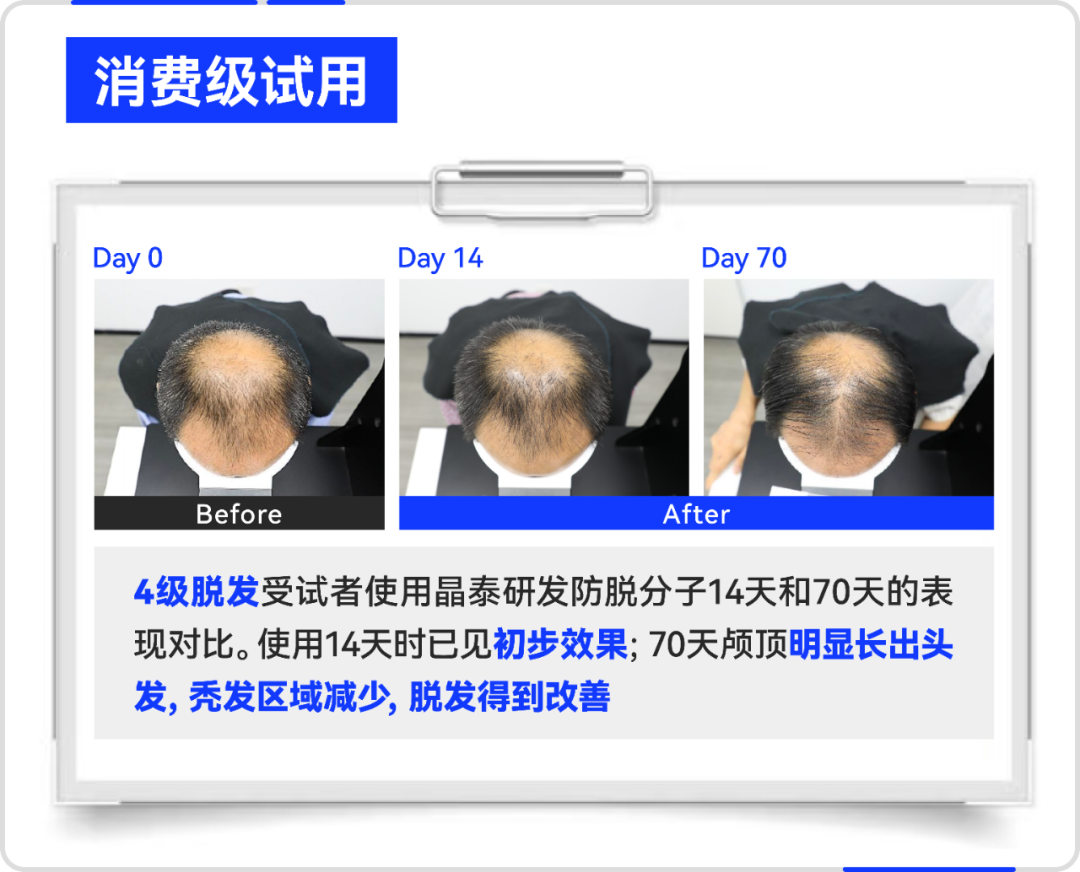 晶泰科技AI破局生发难题,“双子星”新分子联用引领突破性效果