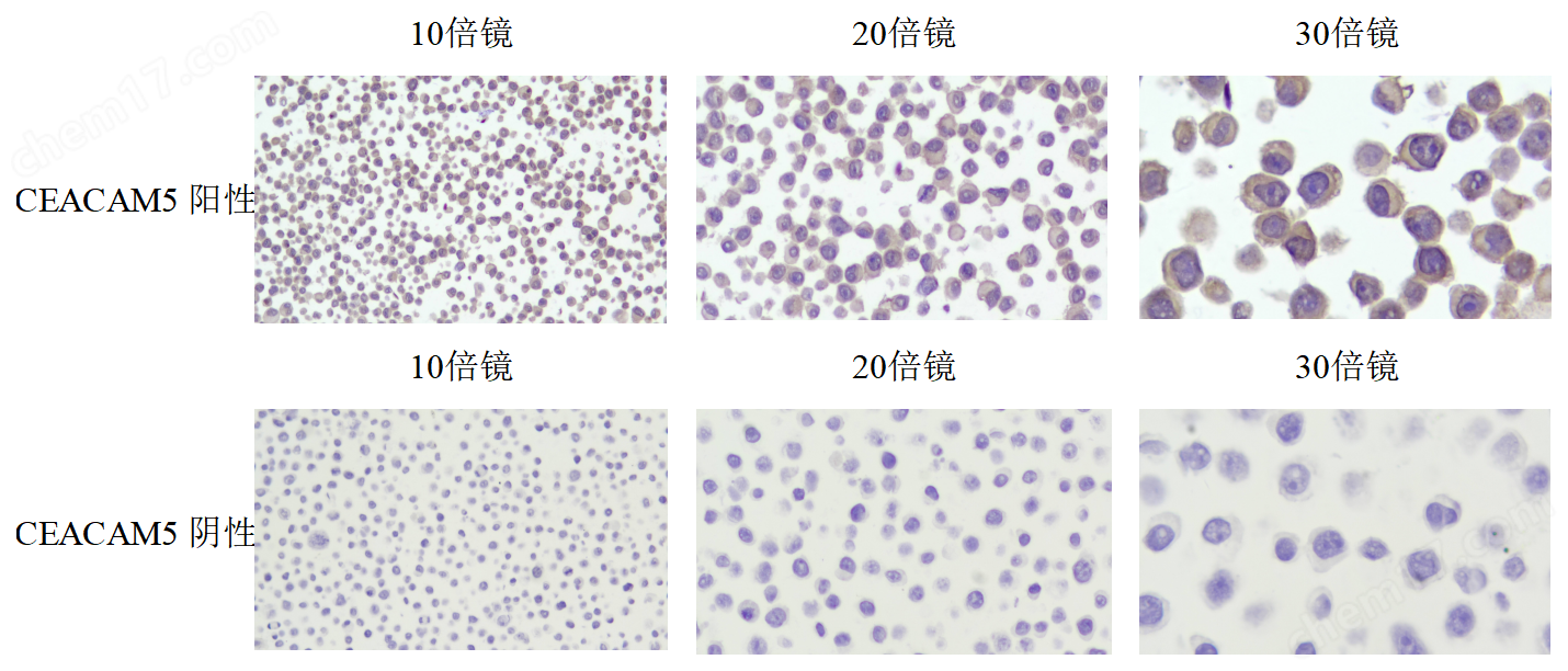 CEACAM5 陰陽二合一 石蠟撈片標(biāo)準(zhǔn)品
